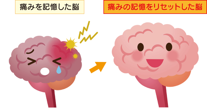 痛みの記憶をリセットする 痛みの記憶をリセットする